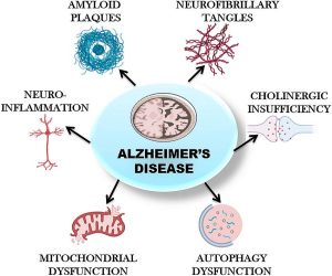 Alzheimer's Science Bee Science News